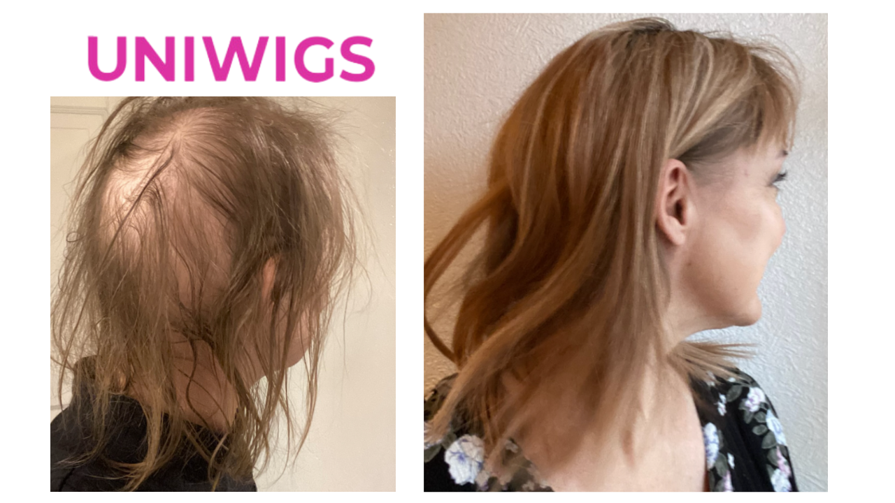 Hair Toppers For Thinning Crown Women